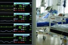 Monitoring in ICU