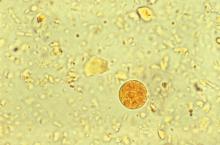 This iodine-stained photomicrograph reveals the presence of an Entamoeba histolytica amoebic parasitic cyst.