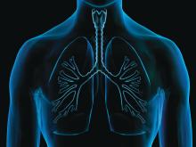 A virtual imagining of an x-ray of the lungs is shown
