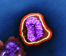 This negative-stained transmission electron micrograph depicts the ultrastructural details of an influenza virus particle or “virion.”