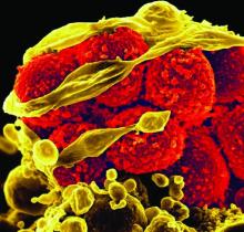 Methicillin-resistant Staphylococcus aureus (MRSA) bacteria