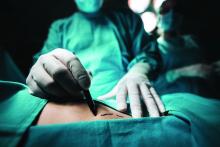 Closeup of a plastic surgeon marking the human skin for surgery.