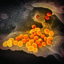 This scanning electron microscope image shows SARS-CoV-2 (orange)—also known as 2019-nCoV, the virus that causes COVID-19—isolated from a patient in the U.S., emerging from the surface of cells (gray) cultured in the lab.