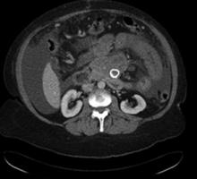 The initial CT scan