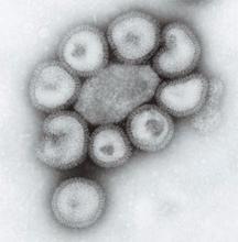This is a depiction of the ultrastructural details of a number of influenza virus particles. This contagious respiratory illness is best prevented when individuals (particularly those at high risk) receive a flu vaccination each fall.