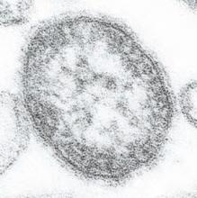 This thin-section transmission electron micrograph (TEM) reveals the ultrastructural appearance of a single virus particle, or 'virion,' of measles virus.