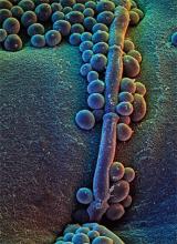 Candida albicans yeast.