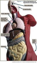 Figure 1. Clinical Manifestations of Hypertensive Emergencies