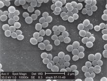 When Should You Decolonize Methicillin-Resistant Staphylococcus aureus (MRSA) in Hospitalized Patients?