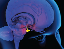 Pituitary gland in the brain. Computer artwork of a person's head showing the left hemisphere of the brain inside. The highlighted area (center) shows the pituitary gland. The pituitary gland is a small endocrine gland about the size of a pea protruding off the bottom of the hypothalamus at the base of the brain. It secretes hormones regulating homoeostasis, including trophic hormones that stimulate other endocrine glands. It is functionally connected to and influenced by the hypothalamus.