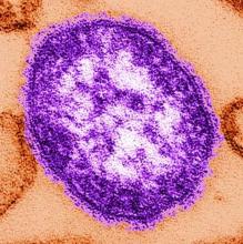 Measles viron